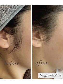 フレグラントオリーブ(fragrant olive)/フェイシャルWax Before ／After