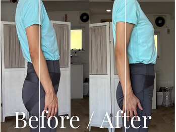 クラウン 原宿 明治神宮前(CROWN)/Before/After