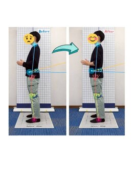 よつば鍼灸整骨院/骨盤矯正で腰痛と姿勢が◎