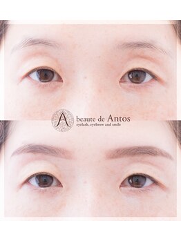 ボーテ ド アントス beaute de Antos/細眉の救世主★眉毛矯正デザイン