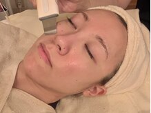 サロン ド プロデュース(salon de PRODUCE)/毛穴の悩みをスカッと！徹底洗浄