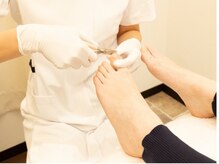 巻き爪、肥厚爪等のトラブルも対応◎