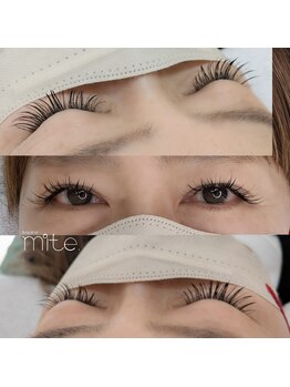 ミテ(mite.)/140本イメージ