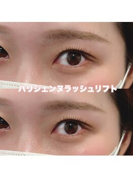 レディエント(Radiant)/パリジェンヌラッシュリフト