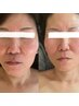 【整うとは、まさにこの事♪】CBDの魅力を再び ハーブオイルヘッドスパ 小顔