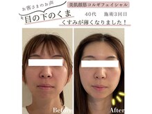 サロンニコ(salon Nico)の雰囲気（クマ/ほうれい線/くすみ/目の下のクマ/たるみ/毛穴/エイジング）