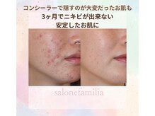 【艶肌水光肌スペシャルデトックスコース】初回価格￥5,500（税込）