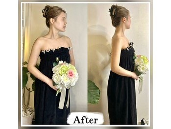 蒼(so)/頭蓋矯正で埋もれ鎖骨にさよなら