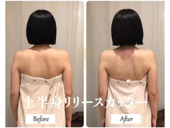 リノ(Lino)/上半身リリースカッター