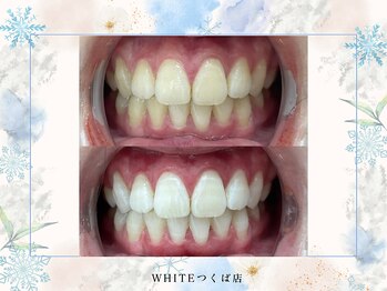 ホワイト つくば店(WHITE)/ビフォーアフター