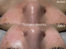 ナチュールムーン(Nature moon.)/毛穴洗浄