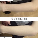 モアトゥインクル 並木通り本店(MORE twinkle)