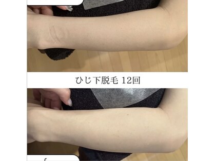 モアトゥインクル 並木通り本店(MORE twinkle)の写真