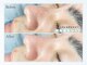 プルティティア 池下 今池 覚王山(Pultitia)の写真