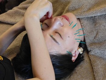 ピンクッション 平尾(PINKSHION)の写真/【高リピート率♪美容鍼でお顔のたるみケア!】年齢とともに気になるほうれい線/肌のたるみ・しわ改善に◎