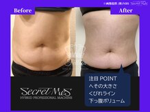 フェレザ 新潟(Felleza)/ウォーキング20分以上を併用