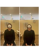 カラダファクトリー 京阪守口市駅店/首・肩凝り　整体