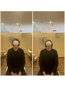 カラダファクトリー 京阪守口市駅店/首・肩凝り　整体