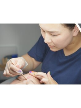 顔脱毛がしたい