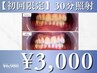 【初回¥3,000】セルフホワイトニング30分¥6,980→¥3,000
