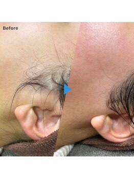 チア(Cheer)/もみあげWAX