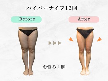 ウェリナ平和堂長久手院/小顔矯正/骨盤矯正/痩身/整体