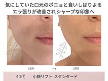 リアン(Lien)の雰囲気（ベース型のフェイスラインもスッキリシャープに◎【たるみ】）