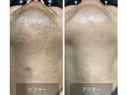エン(EN)の写真