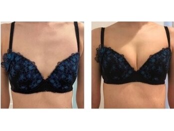 エスビューティー 三軒茶屋(S beauty)/バストケア・池尻大橋・痩身