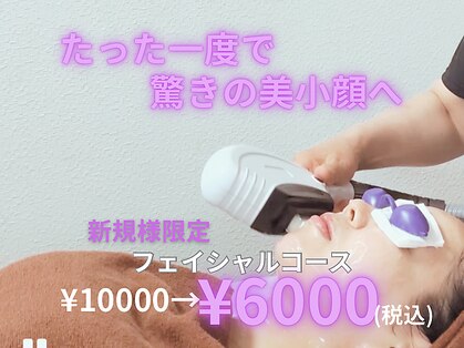 エンジェル(Angel)の写真