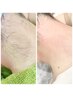 ¥4400→¥3300 夏！！うなじwax！限定10名イベントまとめ髪　涼しげうなじ美人