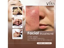 ベラ(VERA)