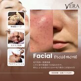 ベラ(VERA)