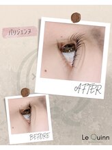 ルクイン 恵比寿 白金(Le Quinn)/Before&After《パリジェンヌ》