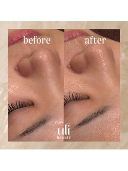ウリ(uli beauty)/比較写真