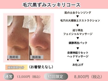 ミルク(MILK)/毛穴黒ずみスッキリコース