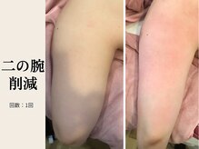 サロン ルイス アディクト(salon Lewis Addict)/
