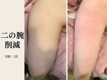 サロン ルイス アディクト(salon Lewis Addict)/
