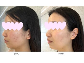ベルメイク(BELLE MAKE)/リベル☆ビフォーアフター