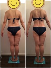 ビューティー サロン ハナ(Beauty Salon hana)/筋膜リリース5回の施術効果