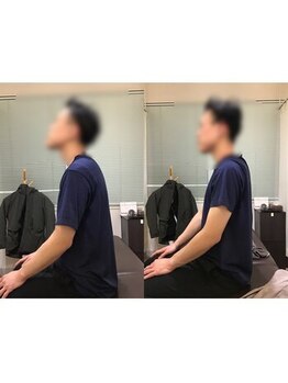 蕨整体院/肩こり/腰痛/首コリ/整体