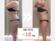 ルナ ボーテ(Lune Beaute)の写真