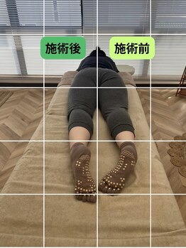 ルミナフローム(LuminaFlowm)/ビフォーアフター