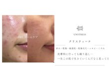 オーシャンブルーム 目黒(OceanBloom)の雰囲気（【フェイシャル】敏感肌・乾燥・赤み・ニキビ・くすみ・色素沈着）