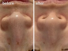 メルシア(merucia)/