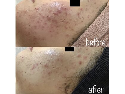 ルリミ(Relimi)の写真