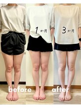 えんじゅ/太もも