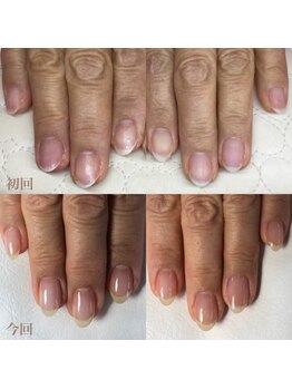 ティヤム(TIAM)/自爪育成ネイル☆