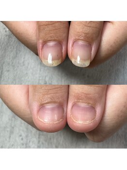 ミル(mill)/自爪育成