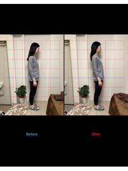 美骨ラボ 自由が丘(美骨Labo)/施術before&after